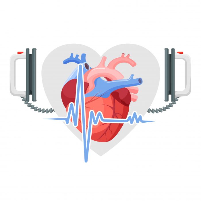 animated heart with defibrillator paddles