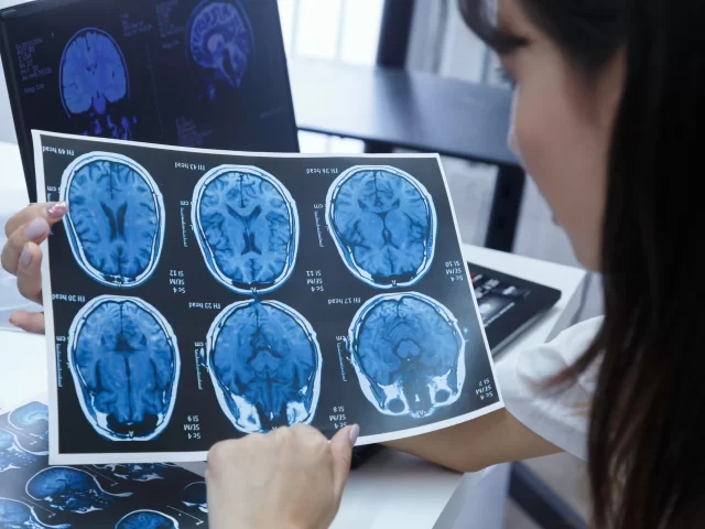 If You Have These Symptoms, a Neurosurgeon May Help