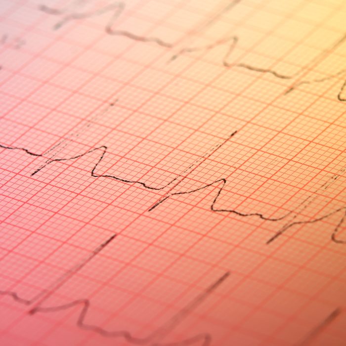 elektrokardiogram heart rate measurement chart