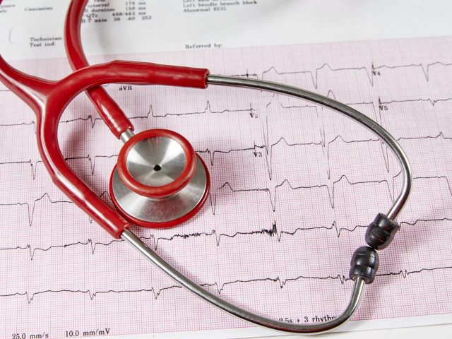 What Does It Mean If I Have an Irregular Heartbeat?