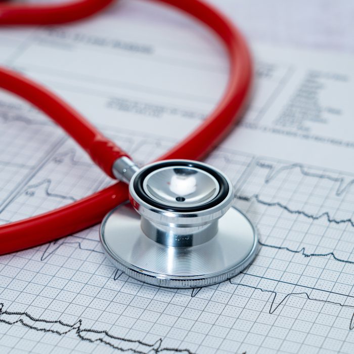 A stethoscope placed on an electrocardiogram
