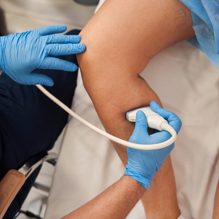 Cropped view of the male doctor wearing protective gloves holding special device while making ultrasound therapy for woman. Ultrasound of the veins of the lower extremities concept