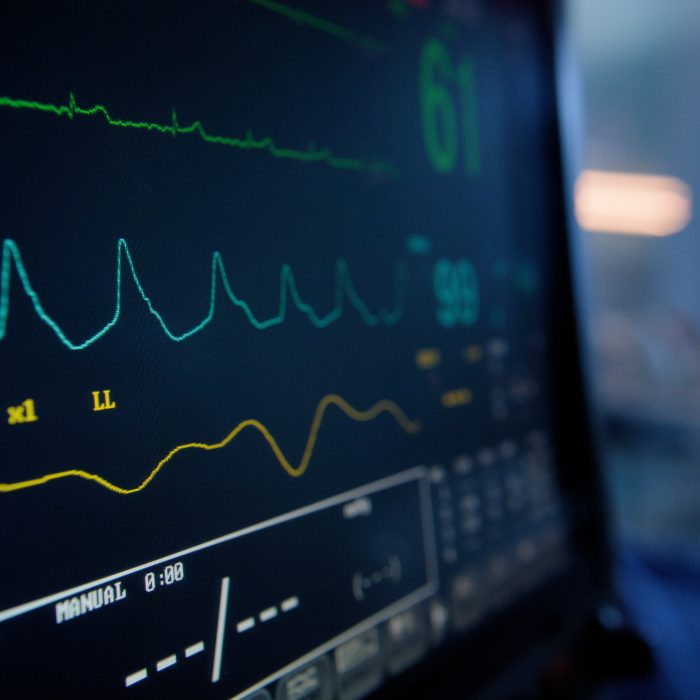 Vital signs monitor, digital and hospital with EKG machine, electronic and medical equipment to help. Emergency, stats and computer in ICU, clinic and healthcare, life and science with technology