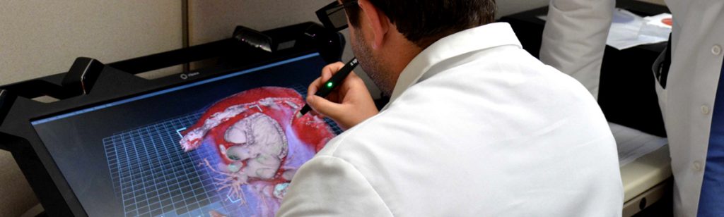 Physician Using Echo Pixel System